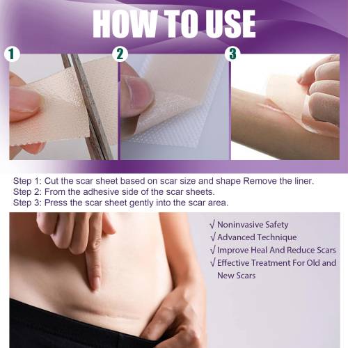 Silicone Gel Skin Patches