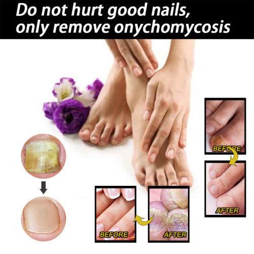 Panthenol Nail Care Liquid