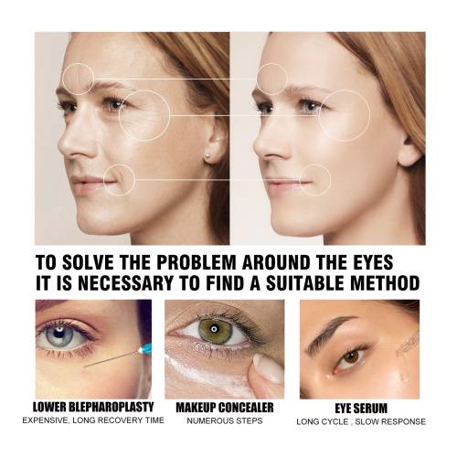 Eye Firming Cream for Crow's Feet & Bags