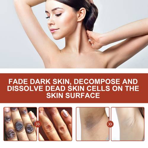 Exfoliating Body Oil for Underarms, Elbows & Knees