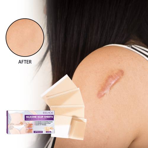 Silicone Gel Skin Patches