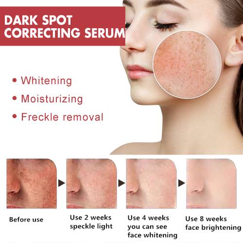 Dark Spot Serum with Niacinamide