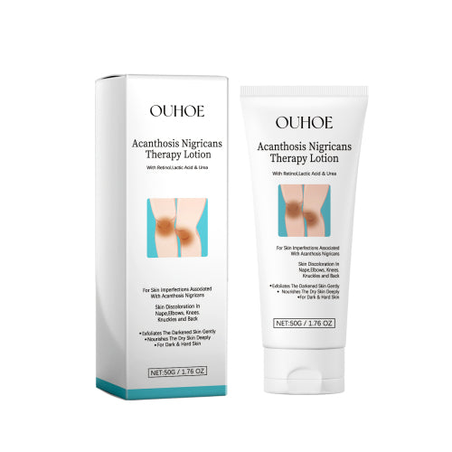 Urea & Lactic Acid Body Lotion for Dark, Rough Areas