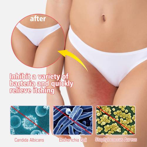 Inner Thigh Moisturising Cream for Women, 20 g