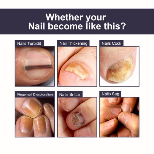Panthenol Nail Essence