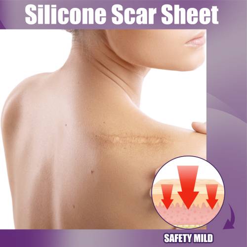Silicone Gel Skin Patches