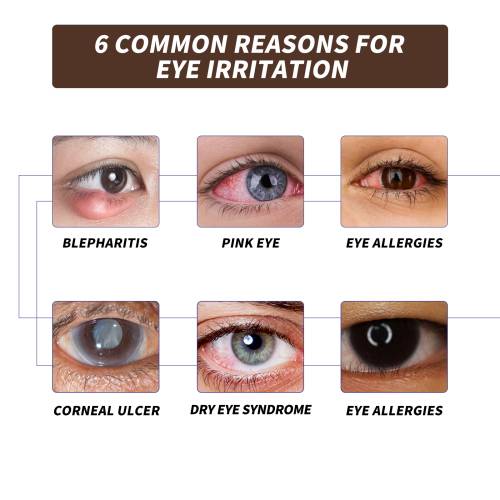 Hyaluronic Eye-Area Mist
