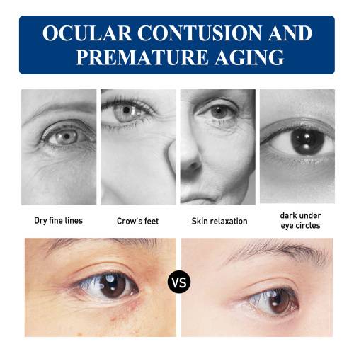 Collagen & CoQ10 Eye Cream for Bags & Dark Circles