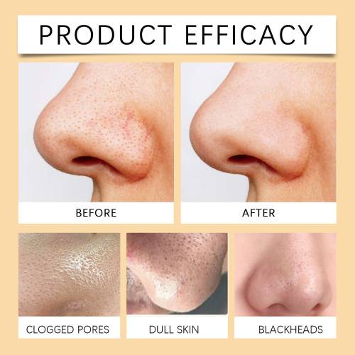 Enzyme Exfoliating Gel with Vitamin C & Niacinamide