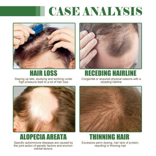 Batana Hair Oil