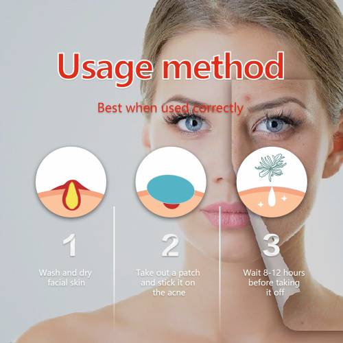 Colourful Hydrocolloid Pimple Patches