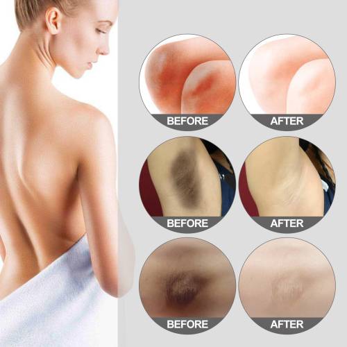 Brightening Cream for Underarms & Knees
