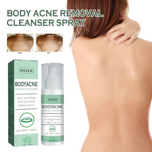 Back & Body Clarifying Spray with Witch Hazel