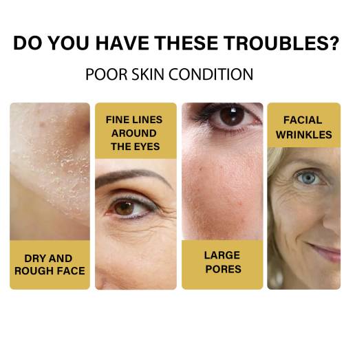 Collagen Protein Thread Lifting Serum Set