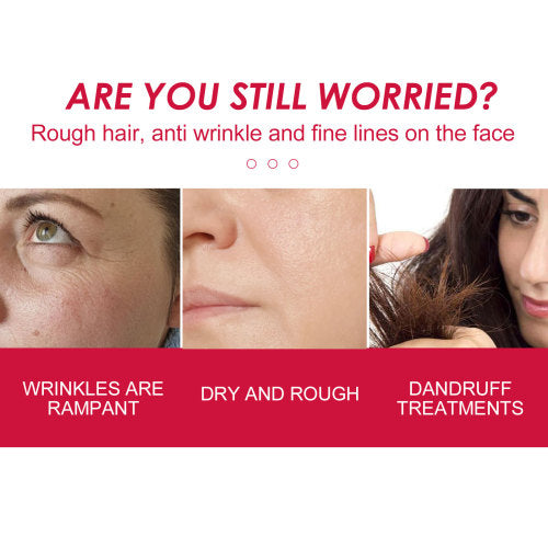 Rosehip Oil for Face, Body & Hair