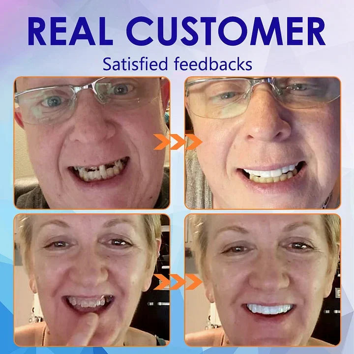 NESLEMY™-🦷Advanced Customized Full Denture Set🦷 (⏰Limited time discount last 30 minutes⏰)