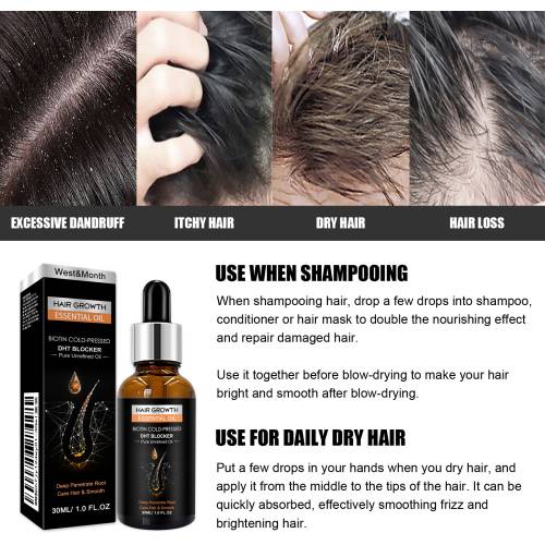 Ginger, Aloe & Castor Hair Oil
