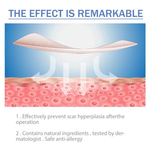 Silicone Gel Sheets