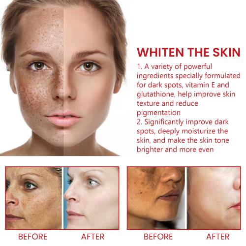 Brightening Cream for Dark Spots, with Jojoba, Grape Seed & Vitamin E