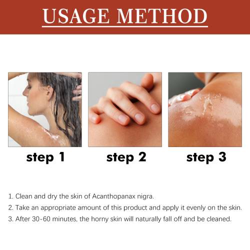 Exfoliating Body Oil for Underarms, Elbows & Knees