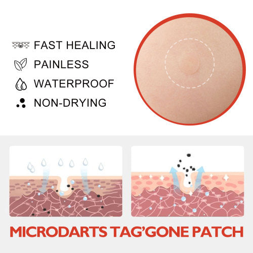 Tea Tree Calendula Pimple Patches