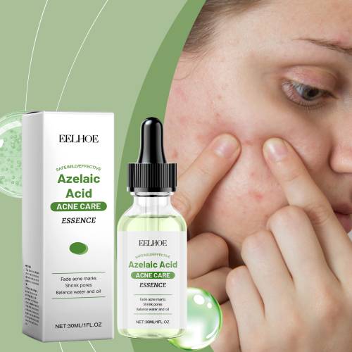 Azelaic Acid Face Essence for Blackheads