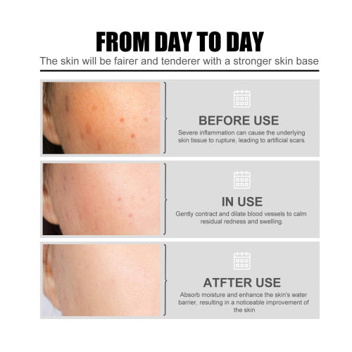 Niacinamide Face Essence for Blemish Marks & Pores