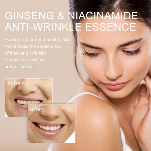Ginseng Eye Area Essence