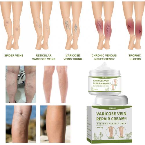 Natural Leg Care Cream