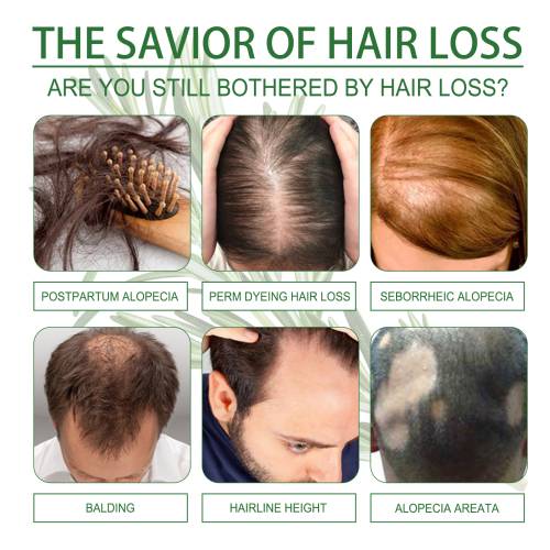 Rosemary Castor Hair Oil
