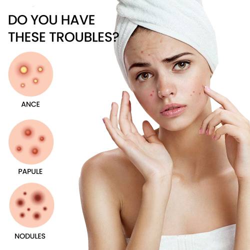 Hydrocolloid Pimple Patches with Tea Tree