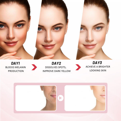 Gentle Face Moisturiser for Dark Spots, 25 g
