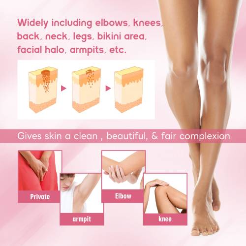 Kojic Acid Brightening Cream for Underarms & Thighs