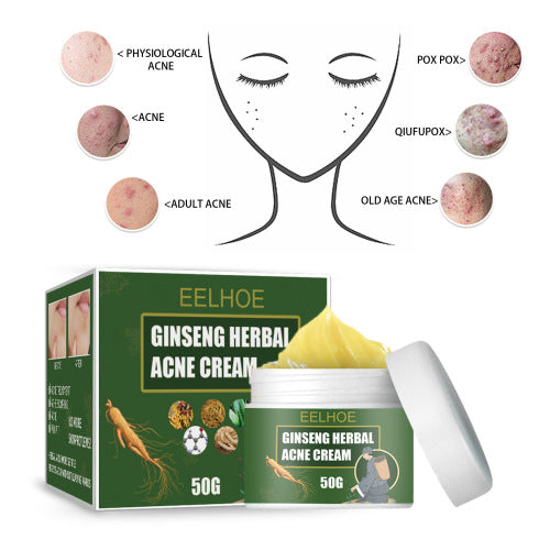 Witch Hazel & Niacinamide Clarifying Face Cream