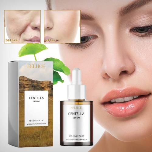 Centella Serum with Hyaluronic Acid