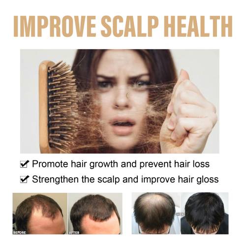 Onion & Biotin Scalp Shampoo, Silicone-Free