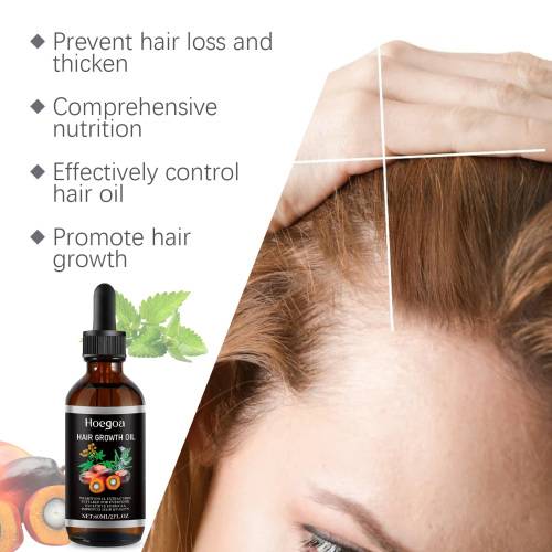 Palm Oil Scalp Massage Serum