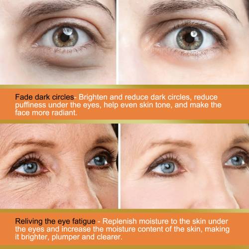 Vitamin C Eye Balm Stick for Dark Circles