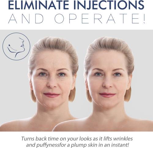 Collagen Vitamin C Face Lift Strips