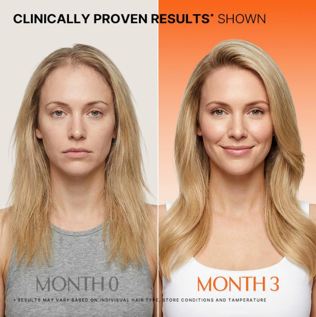 Strengthening Hair & Scalp Serum for Fuller-Looking Hair