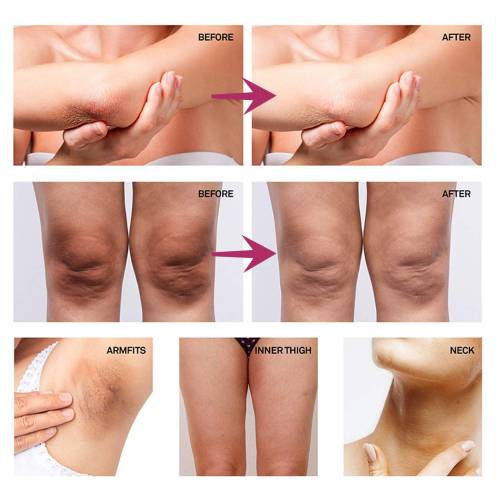 Underarm Brightening Cream with Collagen