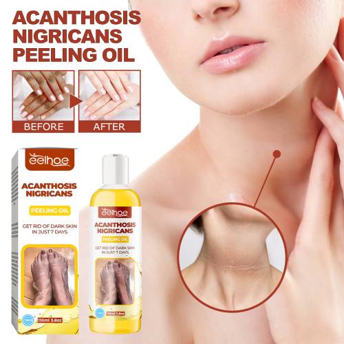 Exfoliating Body Oil for Underarms, Elbows & Knees