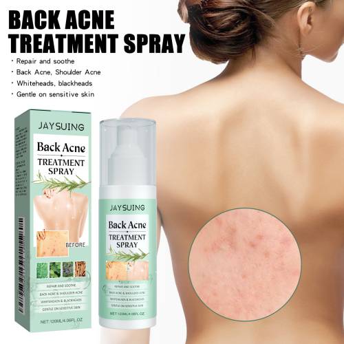 Back & Body Clarifying Spray with Salicylic Acid