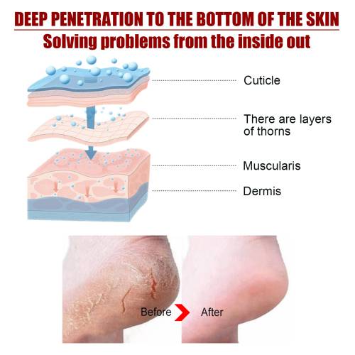 Exfoliating Foot Peel Mask
