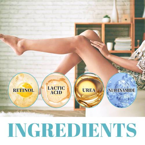 Urea & Lactic Acid Body Lotion for Dark, Rough Areas