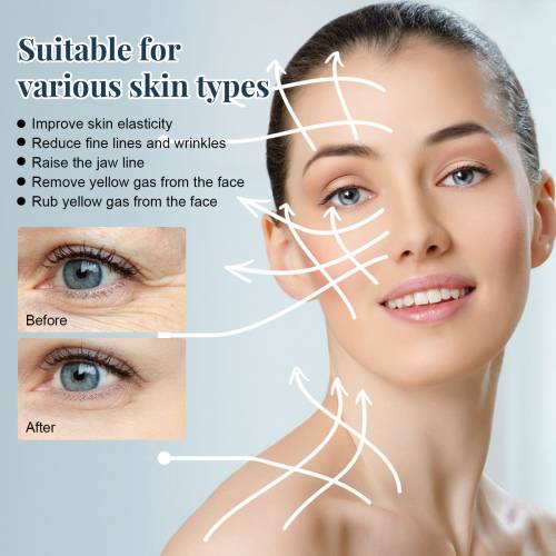 Collagen Silk Protein Threads