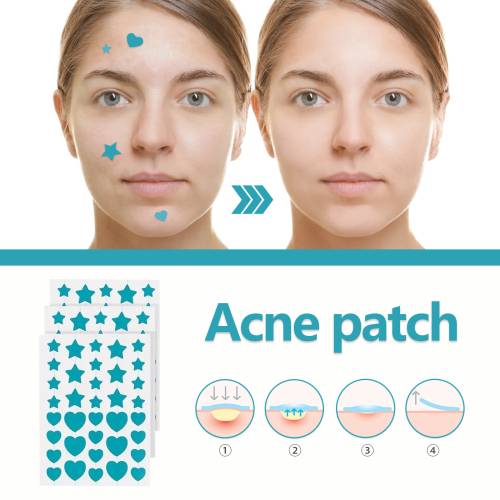 Invisible Hydrocolloid Patches