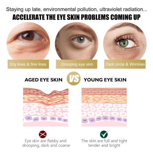 Retinol & Collagen Eye Stick for Bags & Dark Circles