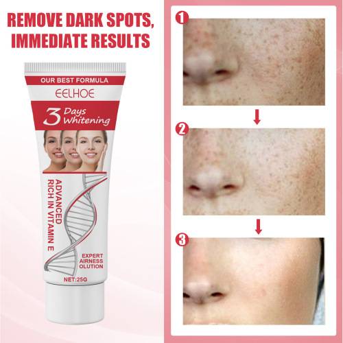 Gentle Face Moisturiser for Dark Spots, 25 g