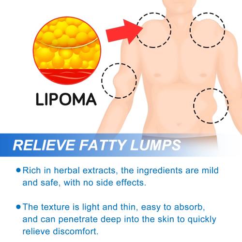 Roll-On Body Moisturising Solution